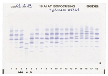 IEF pattern on agarose gel : Z in lane 4