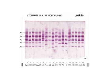 IEF pattern on agarose gel : SRoubaix in Lane 7