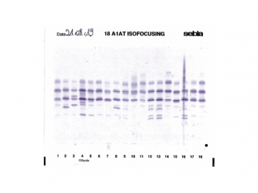 IEF pattern on agarose gel : Ofeyzin in Lane 4