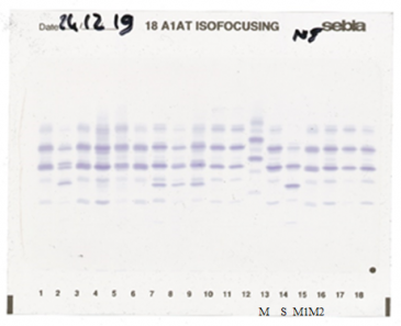 IEF pattern on agarose gel : S in lane 14