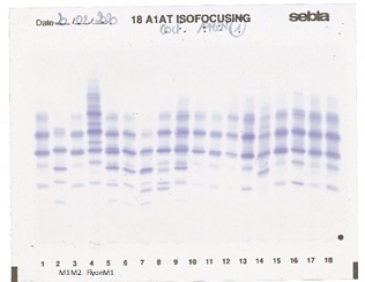 IEF pattern on agarose gel : Flyon in Lane 4