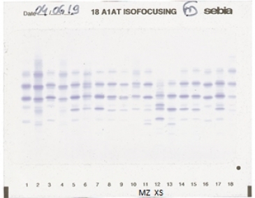 IEF pattern on agarose gel : XS in Lane 12