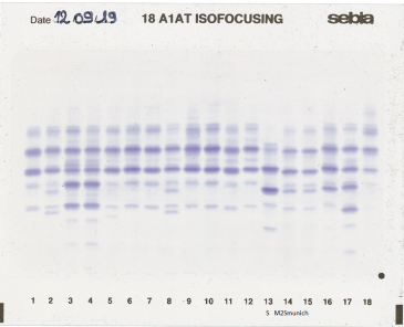IEF pattern on agarose gel : M2Smunich in lane 14
