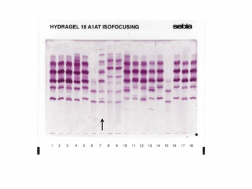 Arrow indicates the position of the MwurzburgZ profile