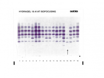 The arrow indicates the position of the MheerlenZ profile