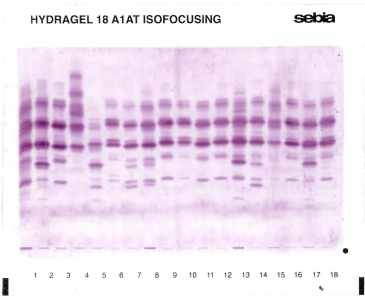 Profile M1Q0lille in lane 9