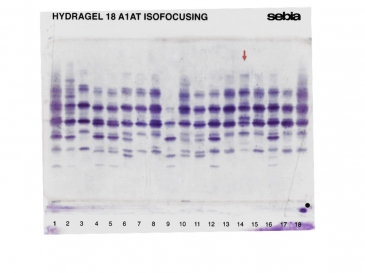 IEF pattern on agarose gel: M1 Plowell  in lane 14