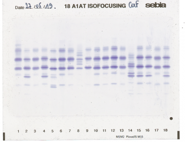 IEF pattern on agarose gel: PlowellS in Lane 14