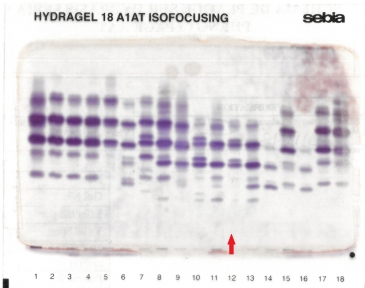 IEF pattern on agarose gel : SQ0granitefalls in lane 12