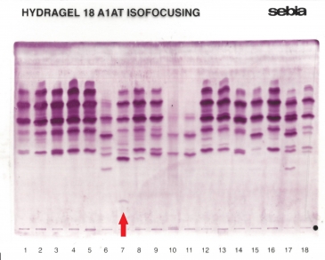 IEF pattern on agarose gel : M1Zbristol in lane 7