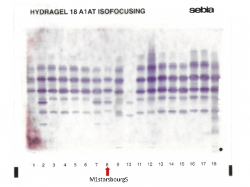 IEF pattern on agarose gel : M1strabourgS in lane 8