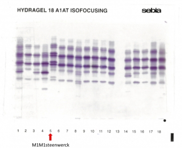IEF pattern on agarose gel : M1M1Steenwerck in lane 5