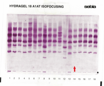 IEF pattern on agarose gel : M3Q0bellingham in lane 14