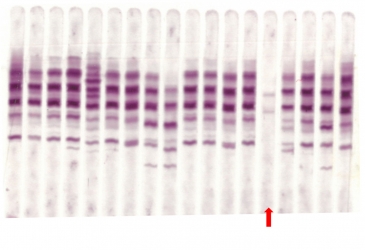 IEF pattern on agarose gel : Mmalton in lane 14