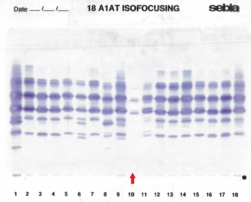 IEF on agarose gel : indicated ba a red arrow in lane 10