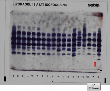 IEF on agarose gel indicated by a red arrow in lane 17