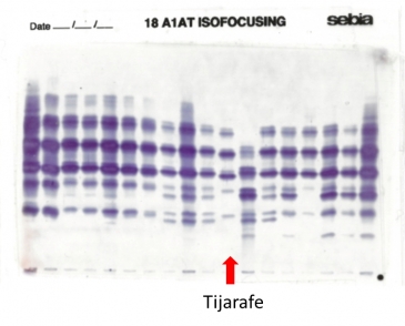 IEF gel on agarose gel in lane 11