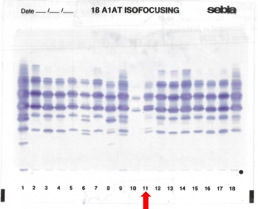 IEF pattern on agarose gel : M1orléans in lane 11