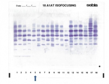 IEF in agarose gel : M3 variant in lane 5